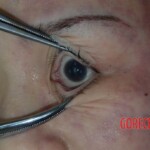 Naked dead girl in morgue