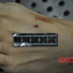 Autopsy of stabbed girl