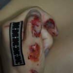 Autopsy of stabbed girl