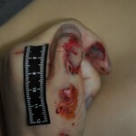 Autopsy of stabbed girl