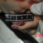 Autopsy of stabbed girl