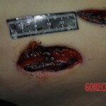 Autopsy of stabbed girl