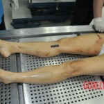 Autopsy of stabbed girl
