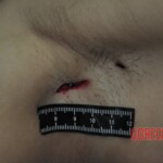 Autopsy of stabbed girl