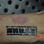 Autopsy of stabbed girl