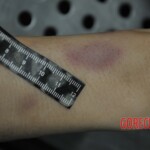 Autopsy of stabbed girl