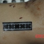 Autopsy of stabbed girl