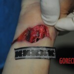 Autopsy of stabbed girl