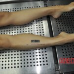 Autopsy of stabbed girl