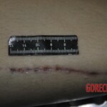 Autopsy of stabbed girl