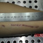 Autopsy of stabbed girl