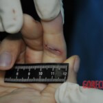 Autopsy of stabbed girl