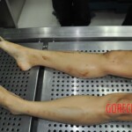 Autopsy of stabbed girl