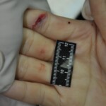 Autopsy of stabbed girl