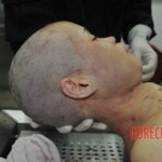 Autopsy of stabbed girl