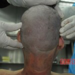 Autopsy of stabbed girl