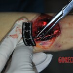 Autopsy of stabbed girl