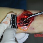 Autopsy of stabbed girl