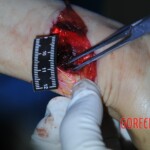 Autopsy of stabbed girl