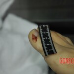 Autopsy of stabbed girl