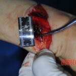 Autopsy of stabbed girl