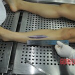 Autopsy of stabbed girl