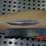 Autopsy of stabbed girl