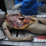 Autopsy of stabbed girl