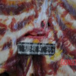 Autopsy of stabbed girl