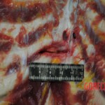 Autopsy of stabbed girl