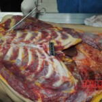 Autopsy of stabbed girl