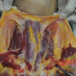 Autopsy of stabbed girl