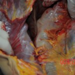 Autopsy of stabbed girl