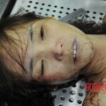 Autopsy of stabbed girl