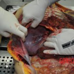 Autopsy of stabbed girl