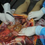 Autopsy of stabbed girl