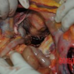 Autopsy of stabbed girl