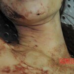 Autopsy of stabbed girl