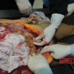 Autopsy of stabbed girl