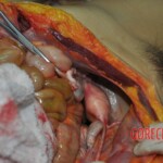 Autopsy of stabbed girl