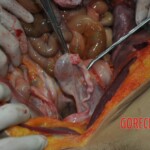 Autopsy of stabbed girl