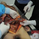 Autopsy of stabbed girl