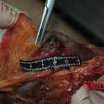 Autopsy of stabbed girl