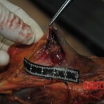 Autopsy of stabbed girl