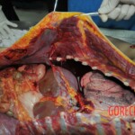 Autopsy of stabbed girl