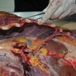 Autopsy of stabbed girl