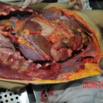 Autopsy of stabbed girl