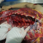 Autopsy of stabbed girl