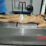 Autopsy of stabbed girl