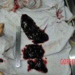 Autopsy of stabbed girl